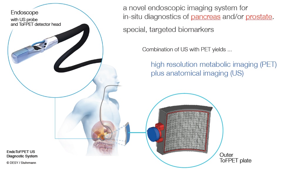 endotofpetus1